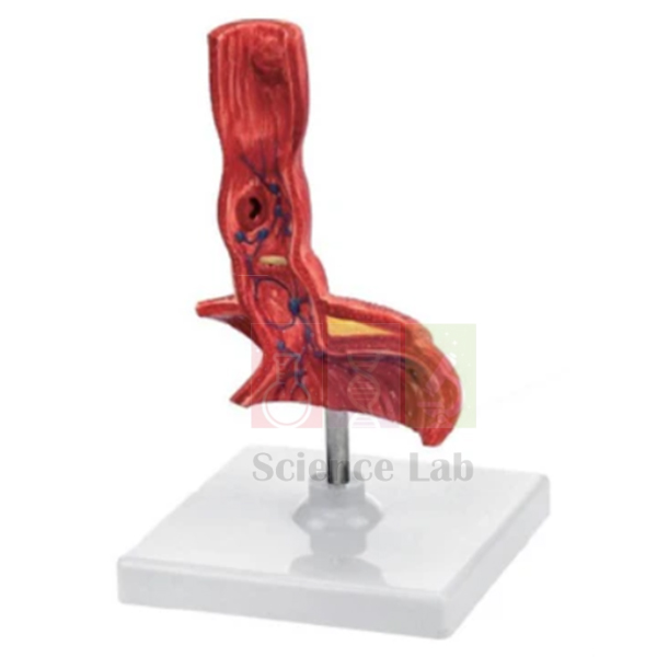 Large Intestine Model